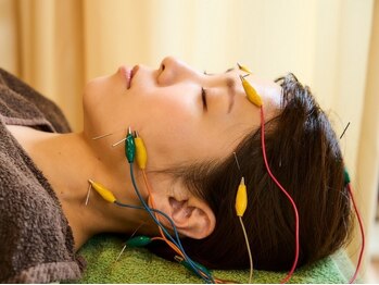 久心宝鍼灸院/通電美容鍼