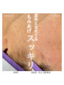 レオン(Leon)/ビフォーアフター