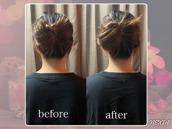 ネクシア 恵比寿(NEXIA EBISU)/太く見えてた首が施術後スッキリ