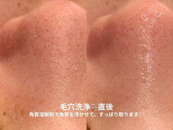 ピブ(pib.)/にゅるにゅると浮き出てきます