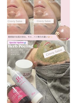 クレヴィー(Creviy)/ハーブピーリング1回の変化