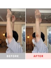 きっと整体院/30代男性　頭痛整体