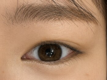 シェリー(Cherie)/before