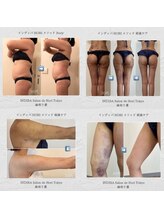 インディバ ホリ ナゴヤ ハニーズビューティー(INDIBA HORI NAGOYA Honey’s beauty)/名古屋インディバ