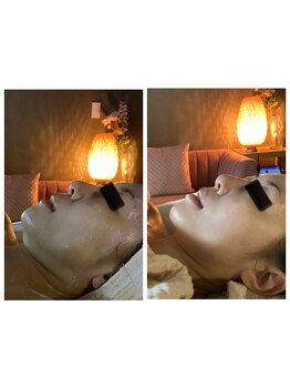 アサガオ(Asagao)の写真/気になるフェイスライン・お顔のむくみ・二重アゴ改善に脂肪分解剤《韓国美容・レモンボトル》