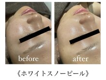 サロンドシェリ(salon de cheri)/ホワイトスノーピール