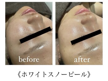 サロンドシェリ(salon de cheri)/ホワイトスノーピール