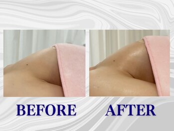 ザモア 福岡天神(THE MORE)/【症例 Before After】