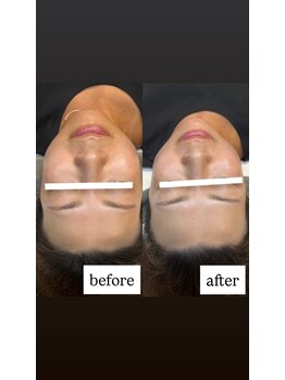 クラン(CLAN)/プロパワーピール