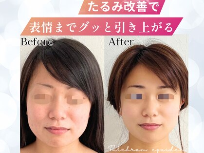 プルチャームエテルナ 代官山店(Pulchram eterna)の写真