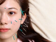 はり処 やまもと