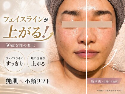 ビューティー ブロッサム(Beauty Blossom)の写真