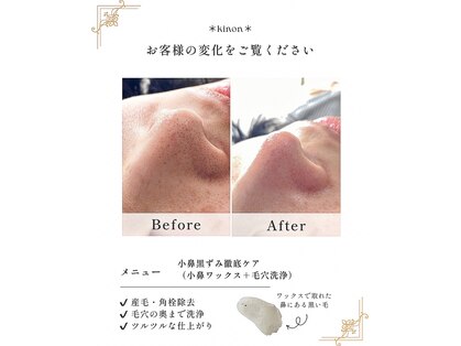 キノン(kinon)の写真