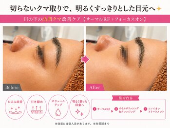 オリエンタルローザ 表参道(Oriental Rosa)/裏ハムラ・表ハムラ気になる方◎