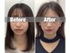 ハリサロンドオフ 堺東店(hari salon de off)の写真