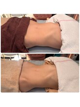 ビューティースタジオ韓美 いわき平/骨盤矯正×腸揉み☆