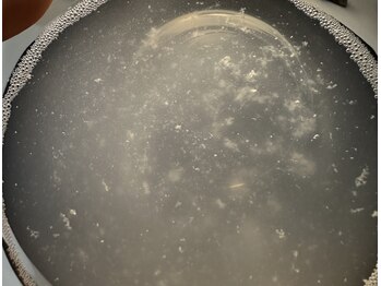 ミュー 刈谷店(mieux)/毛穴汚れの正体