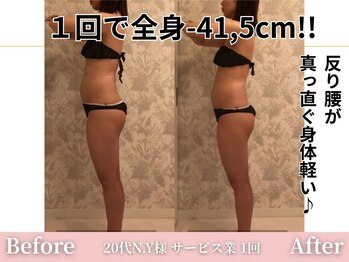 アメリイ 百合ヶ丘 新百合ヶ丘(Amerii)/【痩身】1回全身-41.5センチ痩せ