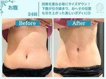 フローフシ∞/【痩身/たるみ】ダイエット革命