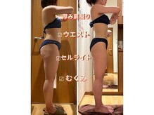 痩せて綺麗になるだけでは無く、肩こりむくみ腰痛改善にも◎◎◎