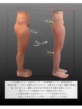 ボスボディ 京橋(BOSS BODY)/脚サイズDOWN得意サロン
