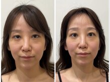 ドクターボディクリスタル(Dr.Body Crystal)の雰囲気(20代 お悩み 目のひらき/フェイスライン)
