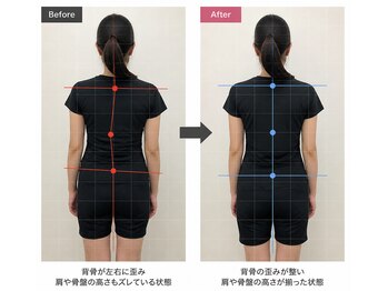 スマイル整骨院の写真/【全身のバランスを整える】姿勢矯正と整体の組み合わせで、歪みのない健やかな美ボディへと導きます。