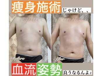 カルマーアンドビー(Calmer & Be.)/【メンズ痩身】Before/After