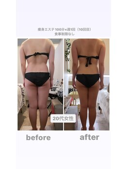 トランキーロ(Tranquilo)/運動をしても痩せにくい方へ