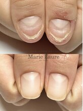 マリーロール 天王寺店(Marie Laure)/自爪育成/深爪矯正/ネイルケア