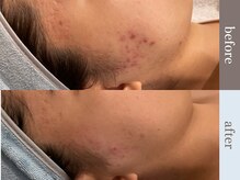 ビューティースタジオ韓美 渋谷店/お客様のbefore/after