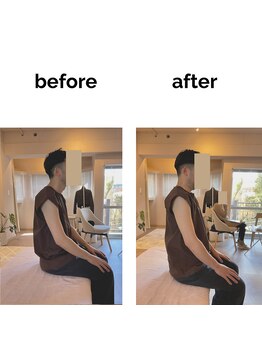 フィデル(fidele)/猫背と腰部負担への対応例