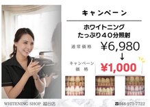 ホワイトニングショップ 越谷店