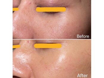 リュミエール デスポワール(Lumiere d'espoir)/白玉ピコ+プラズマ