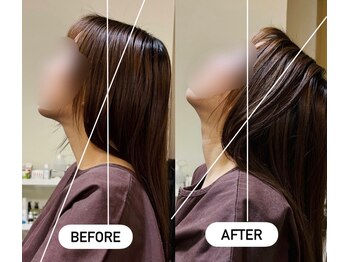 フラット(flat)/ビフォーアフター/首肩の施術