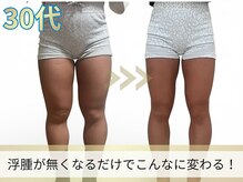 ヨサパーク ア モード ミオ 柴又店(YOSA PARK A modo mio)/浮腫みが取れてほっそり!