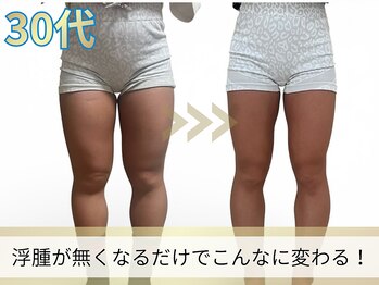 ヨサパーク ア モード ミオ 柴又店(YOSA PARK A modo mio)/浮腫みが取れてほっそり!