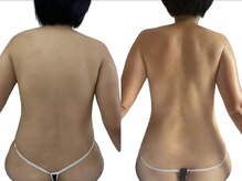 オリーブ(Olive)/4ヶ月間のビフォーアフター