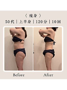 インディバ ホリ ナゴヤ ハニーズビューティー(INDIBA HORI NAGOYA Honey’s beauty)/名古屋インディバ