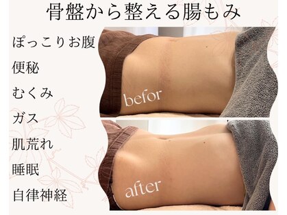 ヘッドトゥトウ(Head to Toe)の写真