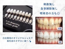 LBSホワイトニング 梅田店の雰囲気（照射パワー2倍☆効果抜群の最新のホワイトニング照射機導入！）