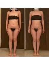 エミナル(EMINALu)/バランスが整うと痩せやすい