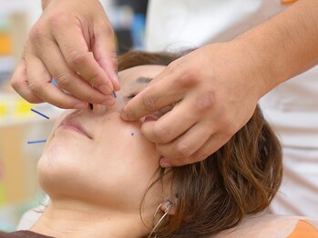 ホッと鍼灸整骨院/やさしい美容鍼灸