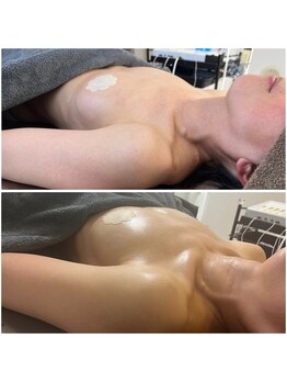 モア(moa)/50代バスト 4回目