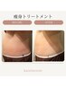 初回半額♪【徹底痩身】オーダーメード集中トリートメント
