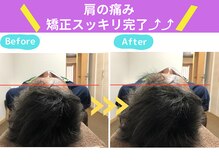 京都中丸整体カイロプラクティック/まき肩