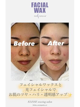 エリス(ELISSE)/お肌のハリ・ツヤ・透明感アップ