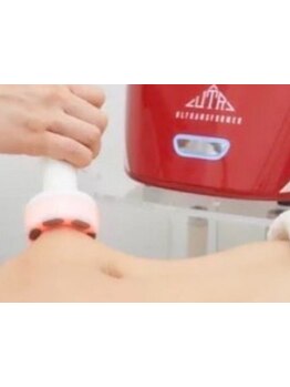 サイズダウンを目指したい