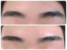 トータルビューティ ノイド(Noid)/メンズ美眉WAX脱毛