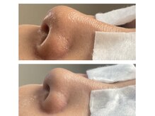 カンナム小顔 海老名店/